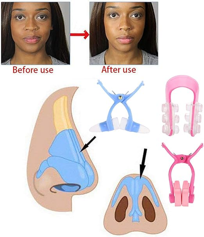 Facial beauty - Nose Shaper